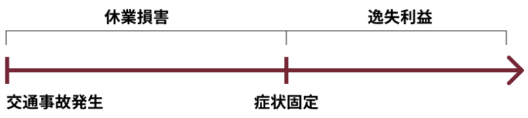 逸失利益