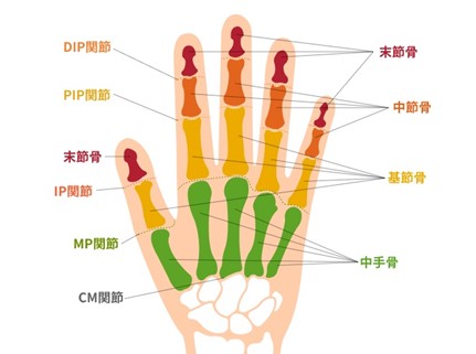 交通事故で手の指を骨折 後遺障害に該当する 賠償金についても解説 リーガライフラボ