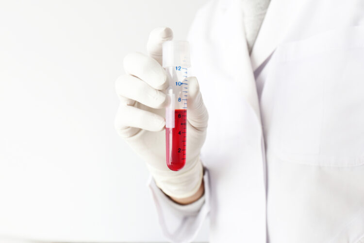 B型肝炎給付金をもらうには、どんな血液検査の結果が必要？
