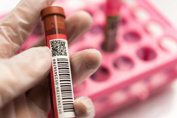 B型肝炎の検査場所によるメリット・デメリットを解説